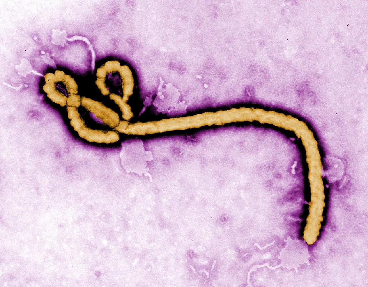 L'ebola a Quèquicom