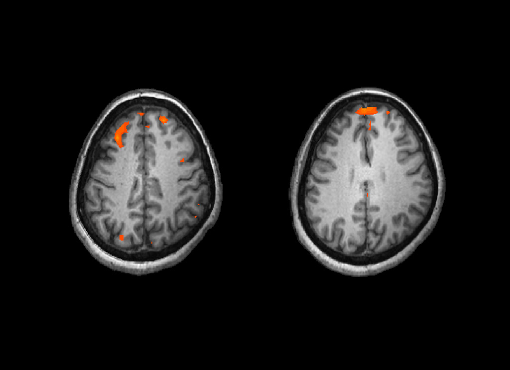 Neurojocs, descobreix la teva ment