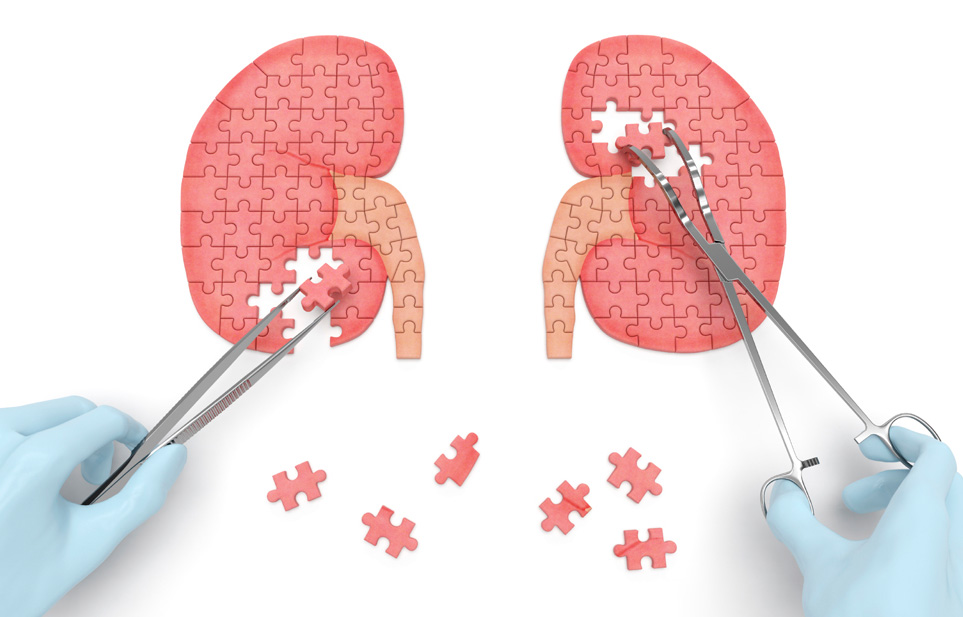 El transplantament renal